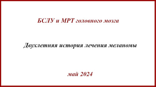 БСЛУ и МРТ головного мозга