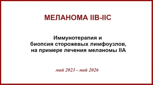 Меланома IIB-IIC. История лечения
