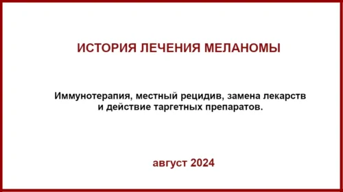 Пример лечения меланомы