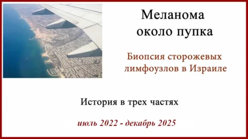 Меланома у пупка. Лечение в Израиле. Биопсия сторожевых лимфоузлов. 3 года после операции