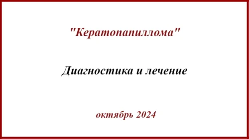 Кератопапиллома. Лечение кератопапилломы.