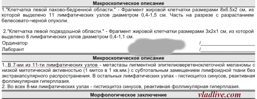 Лимфодиссекция