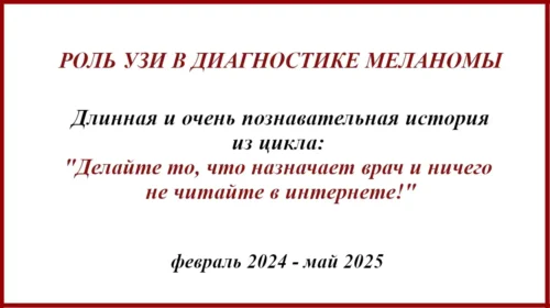 Роль УЗИ в диагностике меланомы. История лечения февраль 2024 - май 2025