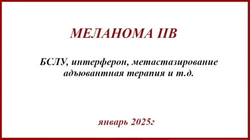 Меланома IIB и БСЛУ