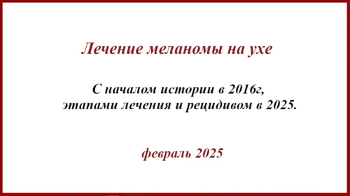 Лечение меланомы на ухе. История с 2016г
