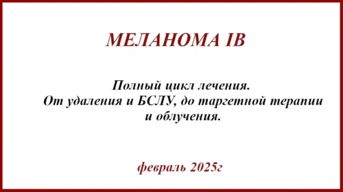 Меланома 2 мм по Бреслоу. IB стадия. История лечения