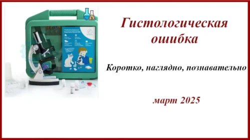Гистологическая ошибка.