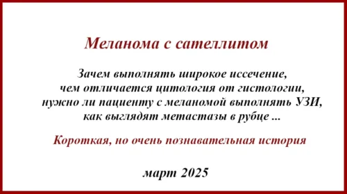 Меланома с сателлитом. История лечения