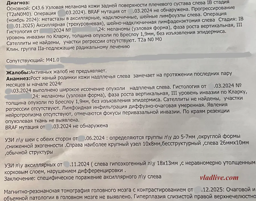 Меланома. Отсутствие биопсии сторожевых лимфоузлов (БСЛУ). История болезни