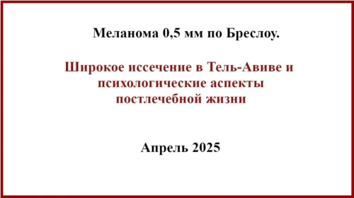 Тонкая меланома 0,5 мм по Бреслоу