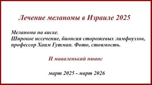 Лечение меланомы в Израиле 2025. История.