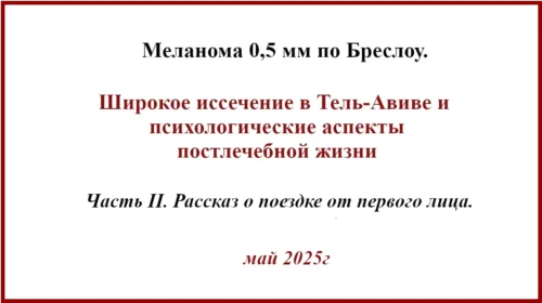Тонкая меланома. Отзыв о лечении в Израиле