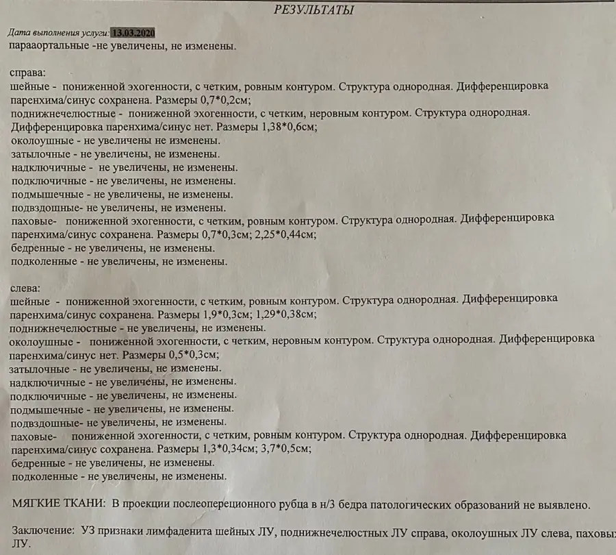 УЗИ