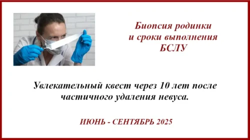 Биопсия родинки. Итоги через 10 лет. Сроки выполнения БСЛУ