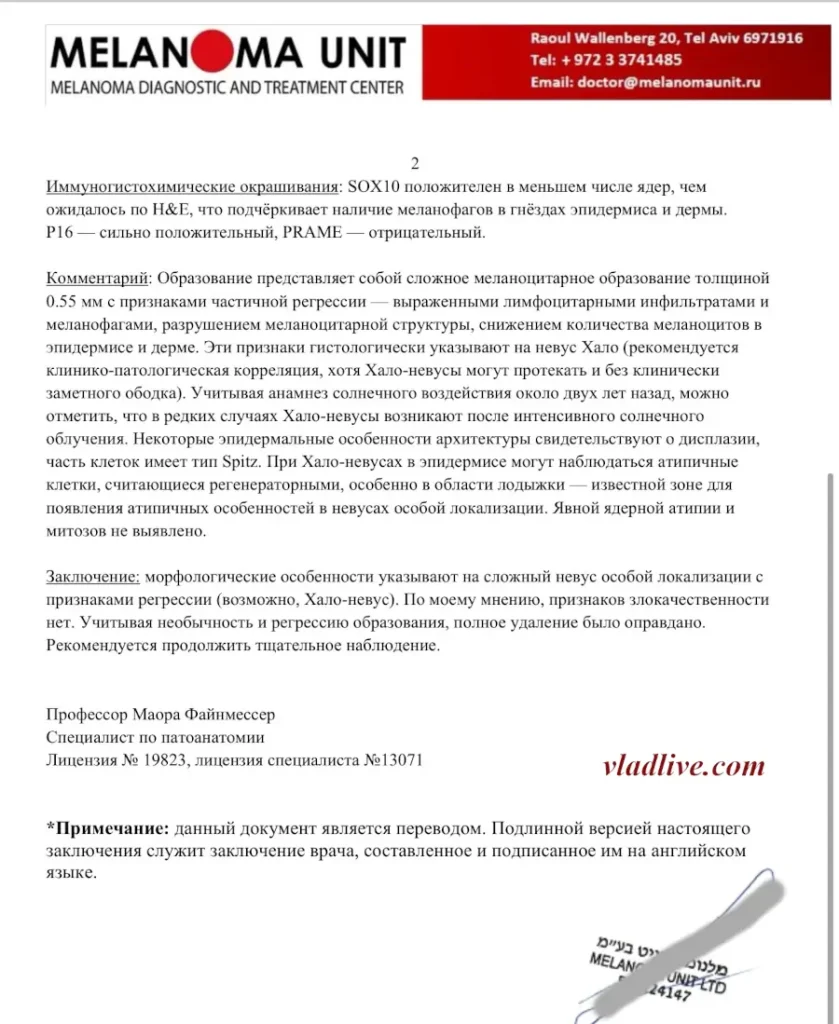 Гало-невус. Ревизия гистологии