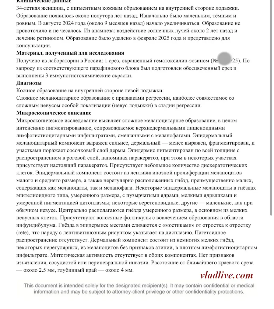 Гало-невус