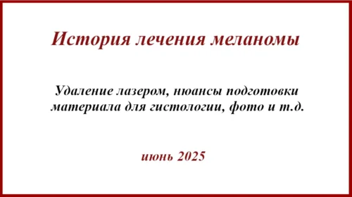 Меланома на бедре. История лечения