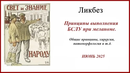 Принципы выполнения БСЛУ