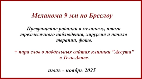 Меланома 9 мм по Бреслоу. История лечения