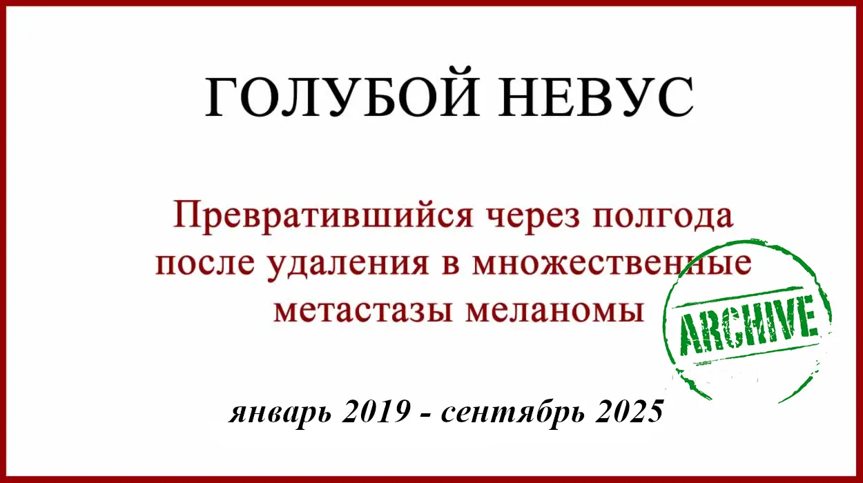 Голубой невус. Ошибка гистологии и её последствия Ошибки гистологии. Голубой невус / меланома. История лечения и победы