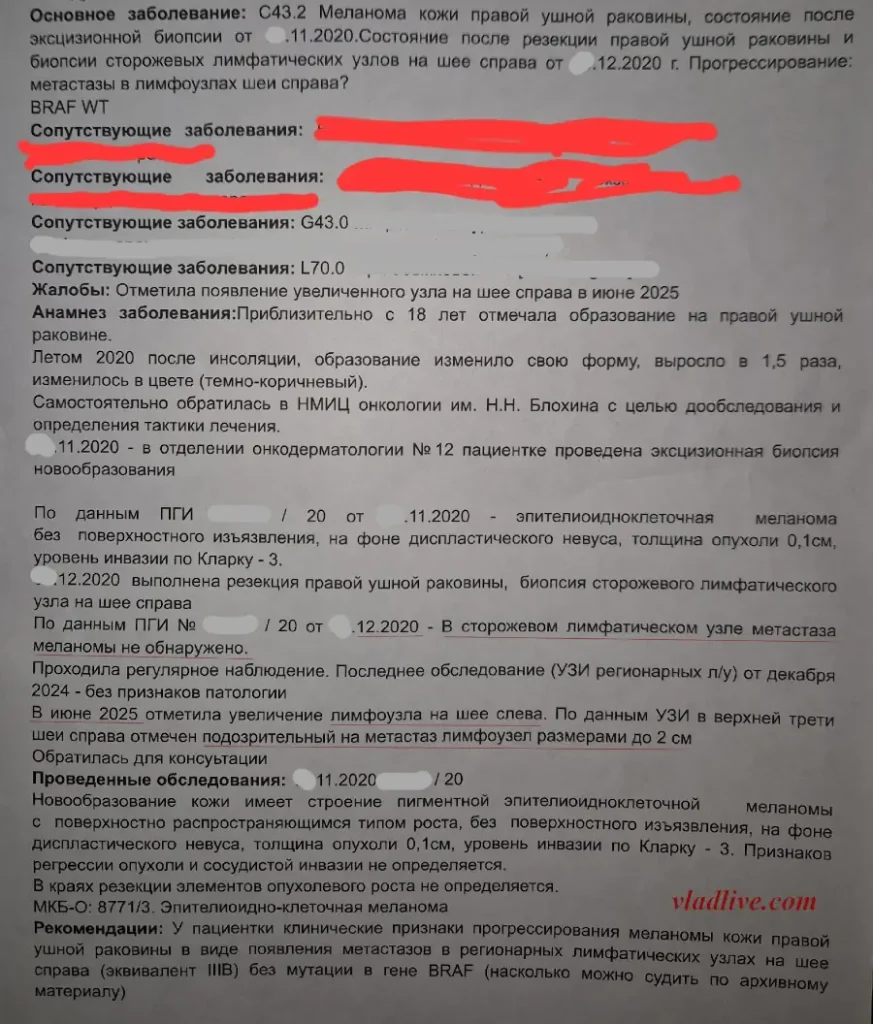 Меланома на ухе. История болезни