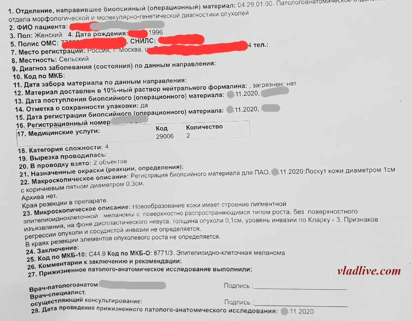 Меланома на ухе. Гистология