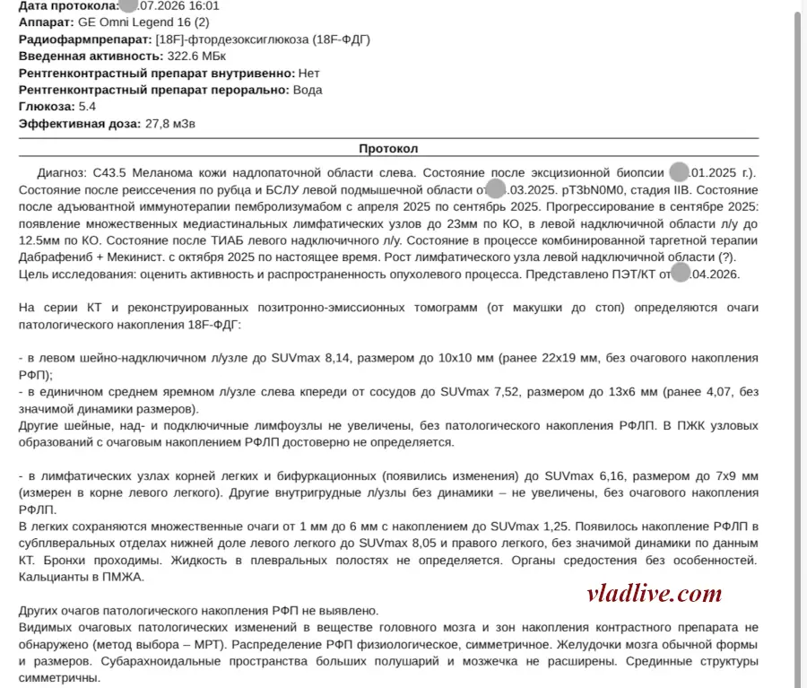 ПЭТ КТ. Изменения в лимфоузлах
