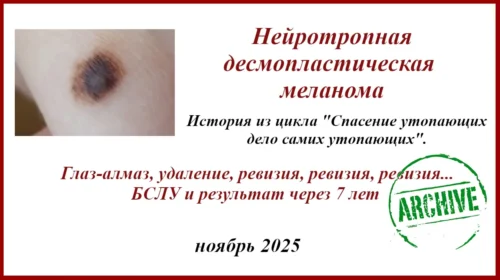 Нейротропная десмопластическая меланома. История лечения.