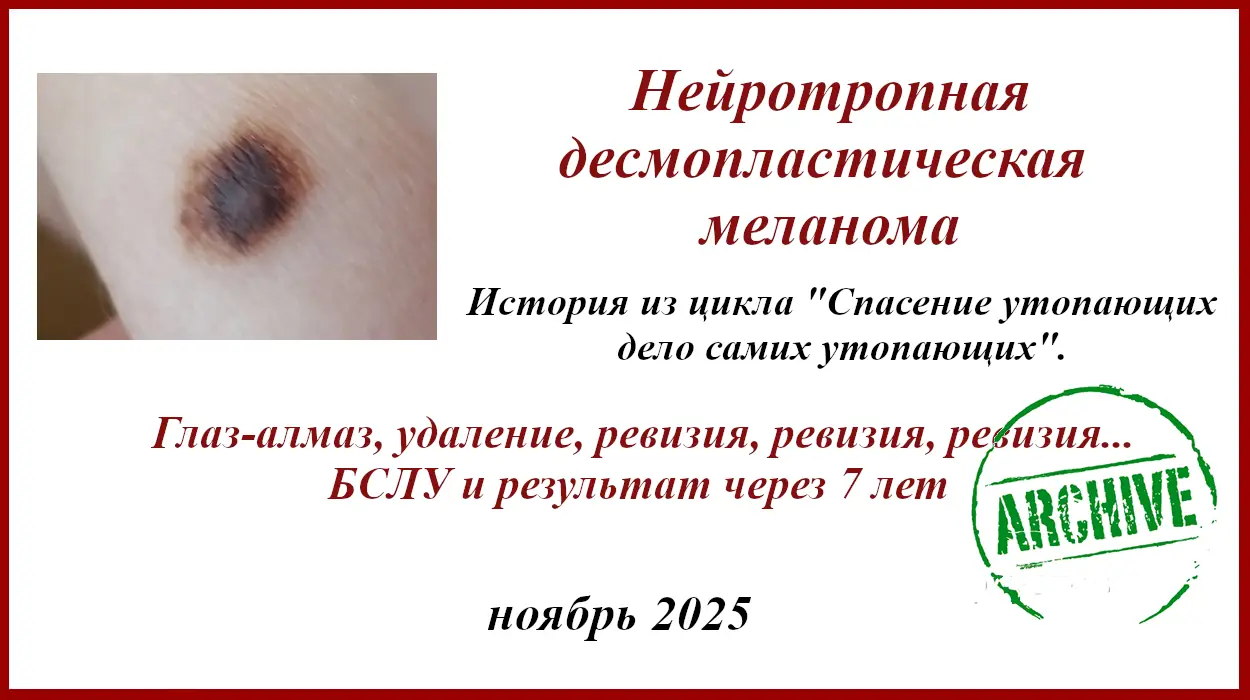Нейротропная десмопластическая меланома. История лечения. Нейротропная десмопластическая меланома. История лечения.
