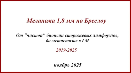 От чистой БСЛУ, до метастазов в ГМ