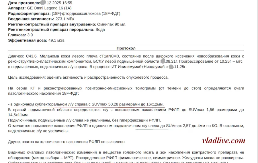 ПЭТ КТ после двух капельниц неоадъювантной терапии Ервой + Опдиво по протоколу "NADINA".