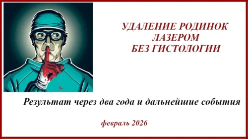 Удаление родинки без гистологии. История лечения меланомы