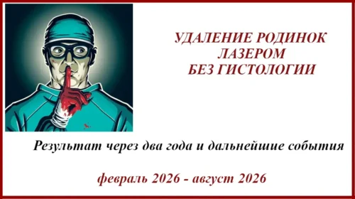 Удаление родинки без гистологии и как результат - история лечения меланомы