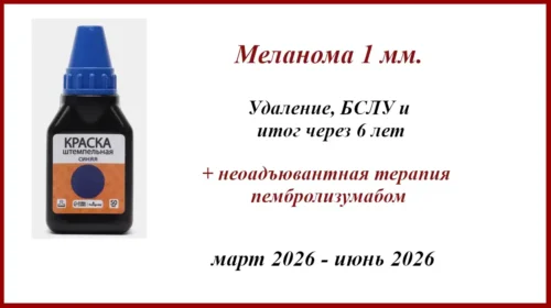 Меланома 1 мм по Бреслоу. БСЛУ и результат через 6 лет. Лимфодиссекция и пембролизумаб