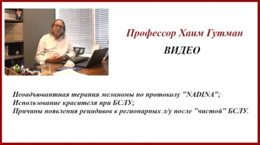 Лечение меланомы. БСЛУ (биопсия сторожевых лимфоузлов) и "NADINA". Профессор Хаим Гутман. Видео.