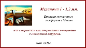 Биопсия сигнального лимфоузла в Москве. Реалии.