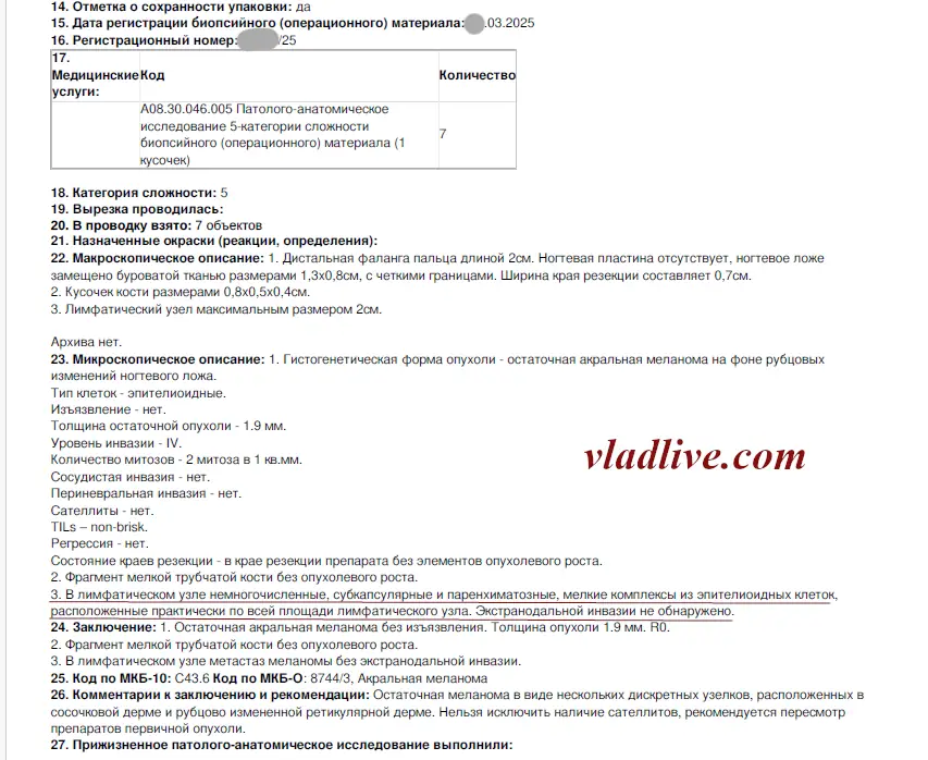 БСЛУ, метастаз меланомы в лимфоузле