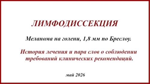 Меланома на голени, БСЛУ и клинические рекомендации. Лечение меланомы. Лимфодиссекция, которую выполнили с большим опозданием
