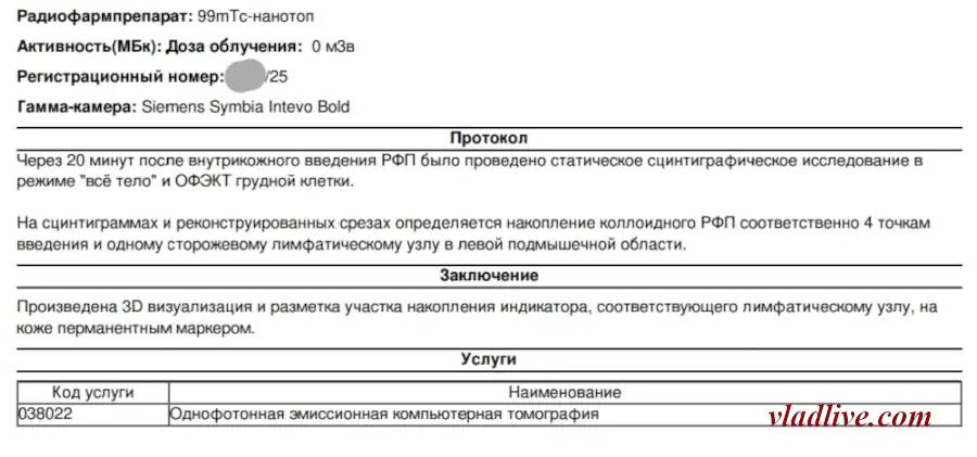 Лимфосцинтиграфия