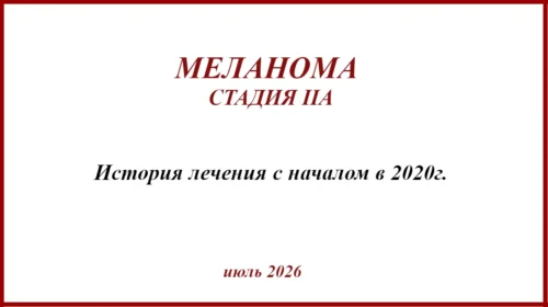 Меланома IIА