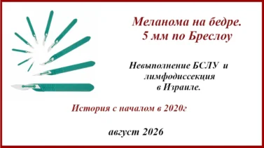 Лимфодиссекция в Израиле.