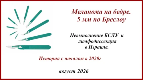 Лимфодиссекция в Израиле.