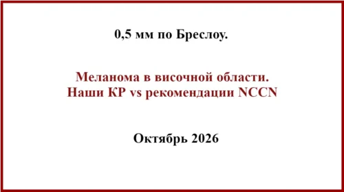 Меланома височной области. 0,5 мм по Бреслоу. БСЛУ, КР и рекомендации NCCN