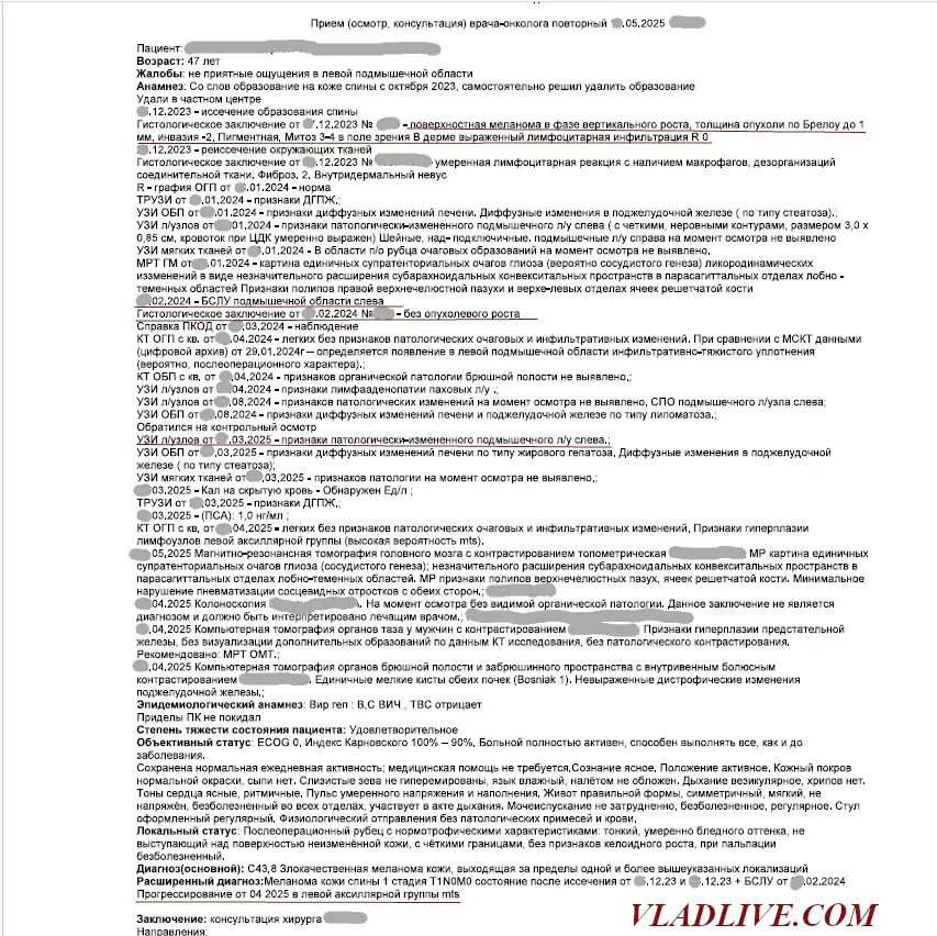 Меланома менее 1 мм по Бреслоу. История болезни