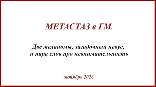 Меланома. Метастаз в ГМ