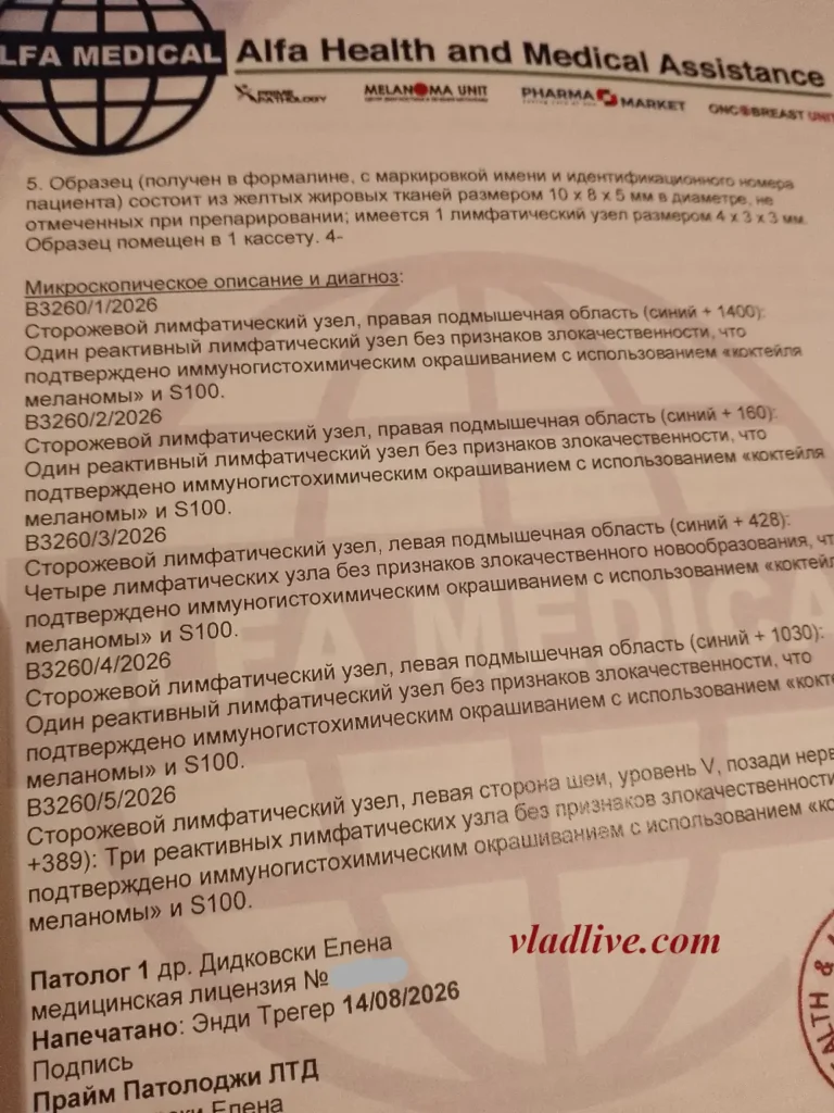 Лечение меланомы в Израиле 2026. Сторожевые лимфоузлы.